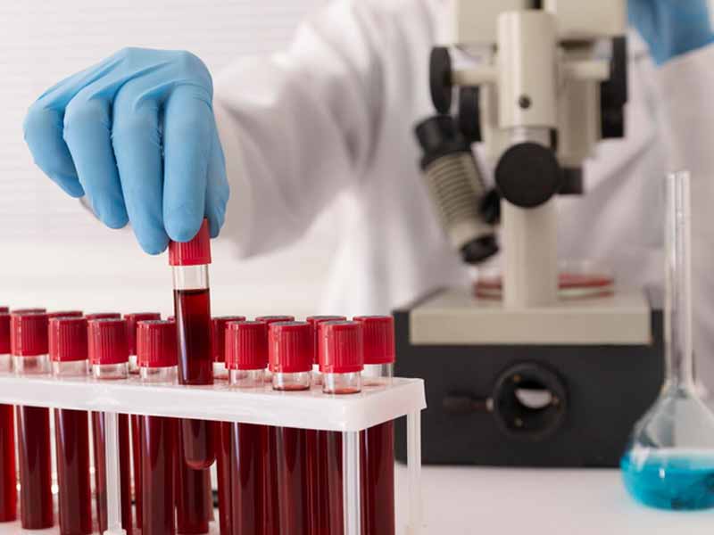 <?php echo esc_attr( get_the_title() ) ?>